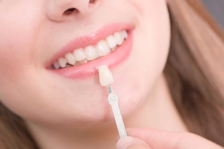 Will I Get Tooth Sensitivity After Having My Veneers Placed?