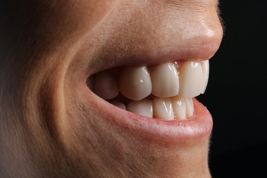 Deciding the Best Porcelain Veneers for Your Smile at Kennedy Dental
